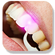 Dental Laser Treatment Bradenton